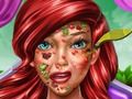 ゲーム人魚姫: 皮膚科医 オンライン