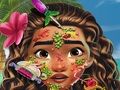 ゲームモアナ スキンドクターオンライン