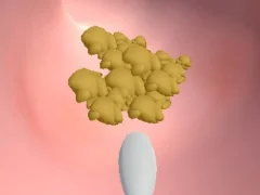 ゲームEarwax Clinicオンライン