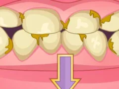 ゲームBad Teeth Makeoverオンライン