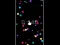 Pop Ball — 無料オンラインゲーム