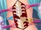 Anna Scoliosis Surgery — 無料オンラインゲーム