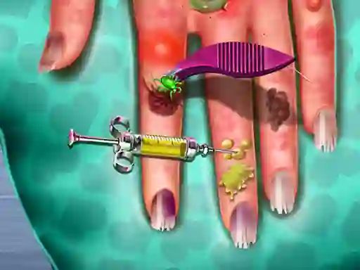 Hand Skin Doctor — 無料オンラインゲーム
