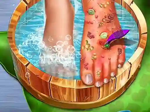 Feet Skin Doctor — 無料オンラインゲーム