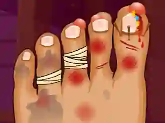 Monster Foot Doctor — 無料オンラインゲーム