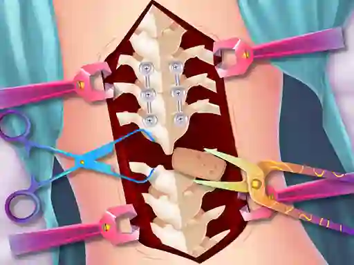 Anna Scoliosis Surgery — 無料オンラインゲーム