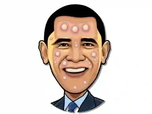 Celebrity Pimple Pop — 無料オンラインゲーム