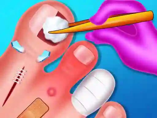 Funny Nail Doctor — 無料オンラインゲーム